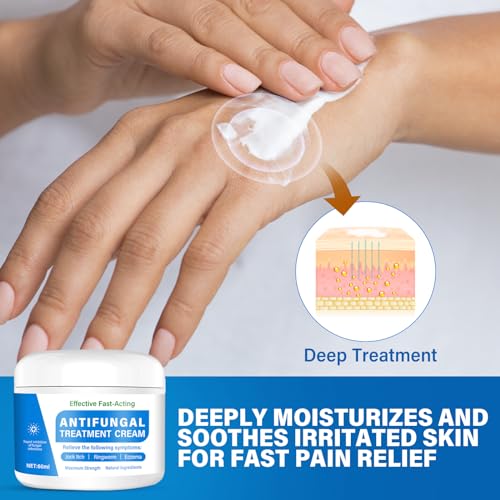 Skin Fungus Cream, Foot Fungus Relief Quick Intensive, Antibody Ringworm, Eczema, Sweat Bubbles, Non-Irritating, Suitable for Face and Body Care, 60 g