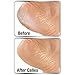 Callex Callus Foot And Heel Ointment - Smoothes & Softens Hard Cracked Feet