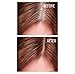Lux Fusion - Hair Building Fibers for Concealing Thinning Hair - Get Thicker and Fuller Hair in minutes - Add Volume - for Men & Women - Medium Brown, 0.88 Oz 25 grams - 3 Month Supply