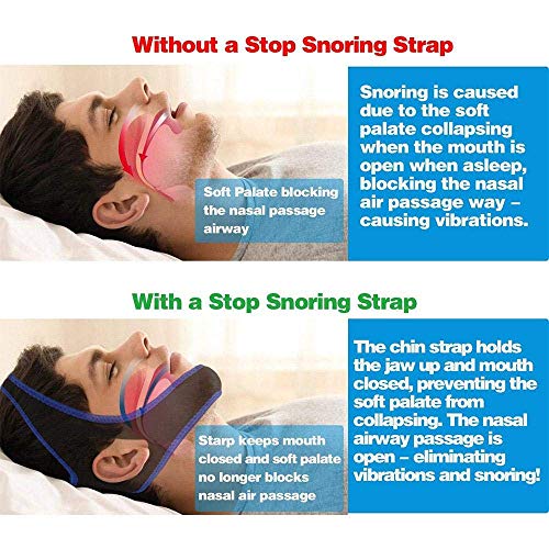 Anti Snoring Chin Strap, Taisk Comfortable Natural Snoring Solution Snore Stopper | Adjustable Effective Stop Snoring Sleep Aid Snore Reducing Aid for Women & Men