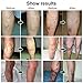 Ofanyia Veins Cream Varicose Veins Treatment Cream Relief Phlebitis Angiitis Inflammation Blood Vessel Health Skin Care