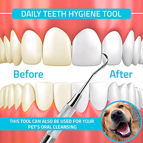 Professional Dental Tartar Scraper Tool Dental Pick, Double Ended