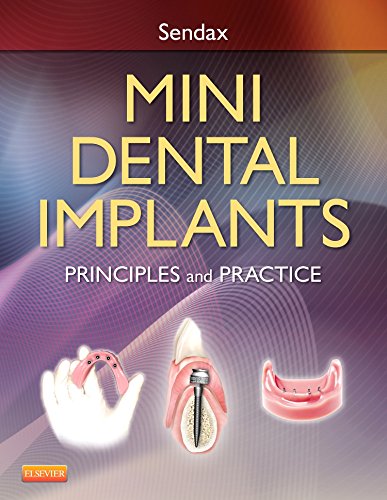 Mini Dental Implants: Principles and Practice - Thumbnail 2
