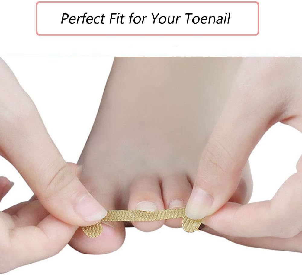 EBANKU 5 Sheets/20 Pcs Ingrown Toenail Corrector Stickers, Toe Nail Treatment Elastic Patch Sticker Corrector Pedicure Tools Fingernail Toe Nail Care Protects Toe Nail: Arts, Crafts & Sewing