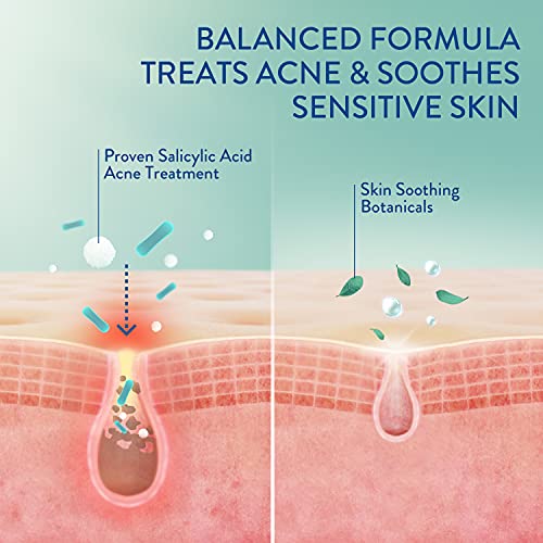 Cetaphil Acne Face Wash, Gentle Clear Clarifying Acne Cream Cleanser