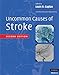 Uncommon Causes of Stroke by