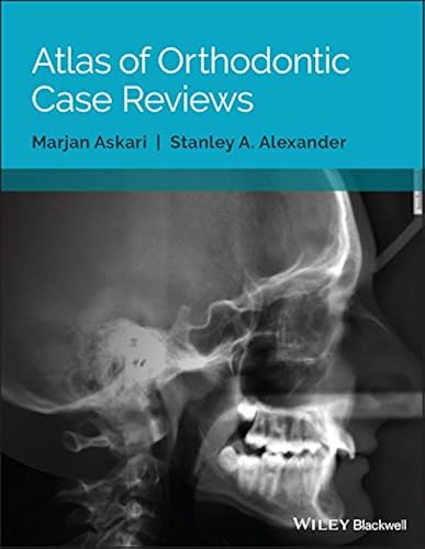 Download Atlas of Orthodontic Case Reviews PDF