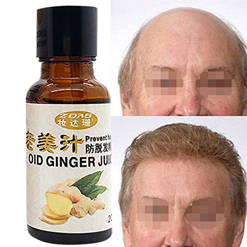 Buy Shoppy Shop Ginger Juice Hair Growth Essence Professional