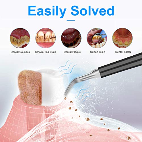 CESTBON Electric Dental Calculus Remover, High Frequency Vibration