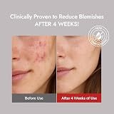 MIZON Good Bye Blemish Soothing Gel Cream 55ml Korean Skincare Acne Spot view 5