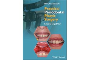 Practical Periodontal Plastic Surgery