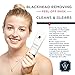 Blackhead Remover Vacuum, Pore Vacuum Electric Rechargeable Blackhead Extractor Tool with 4 Probes & 3 Color Led Light Beauty Lamp Care for Nose