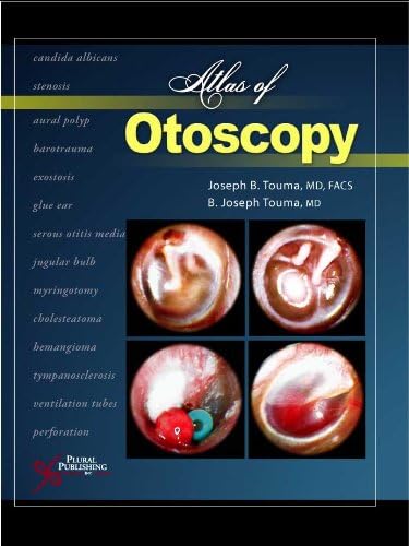 Color Atlas of Oculoplastic Surgery: 9781608310784: Medicine