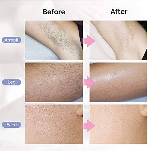 image for FEEKE IPL Hair Removal System for Women and Men IPL Hair Removal Devic