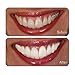 GO SMILE Professional Teeth Whitening Gel & Luxury Toothpaste - Teeth Whitener & Stain Remover Self Care Gifts, No Added Sensitivity - Travel Size for Gift Basket or Stocking Stuffers, Mint 3.4oz