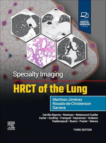 Webb, Müller and Naidich's High-Resolution CT of the Lung