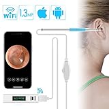 Wireless Otoscope, ROTEK Ear Scope 1.3MP HD Digital Ear Otoscope Inspection Camera Ear Cleaning Endoscope with 6 LED Light Compatible for iPhone Android, iPad Mac Computer PC 6.5FT