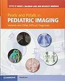 Pearls and Pitfalls in Pediatric Imaging: Variants