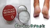 Glysolid Glycerin Cream 125ml Allantoin for Dry Skin - European Formula view 6