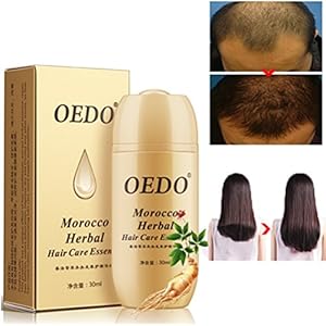 Morocco Herbal Ginseng Hair Care Essence Treatment For Men And Women Hair Loss Fast Powerful Hair Growth Serum Repair…