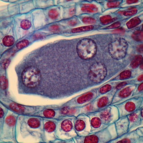 Lily Ovulary, First 4-Nucleate Stage (Megaspores), c.s., 12-20 m Microscope Slide