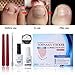 Ingrown Toenail Corrector Kit, Pedicure Tools, LuckyFine 6pcs Nail File Elastic Patch Straightening Clip Nail Glue Toe Nail Care Pedicure Tool