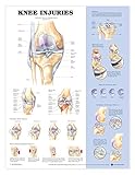 Knee Injuries Anatomical Chart