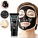 Blackhead Cleansing Mask Finewind Acne Face Mask Deep Clean Blackhead Oil-control Anti-aging Acne Treatment
