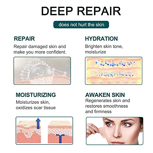 Large Roll Silicone Scar Sheets, Good Adhesive Waterproof Washable Soft