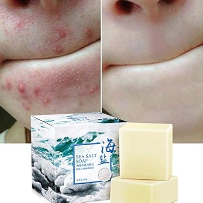 oily soap care