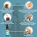 Hair Growth Serum, Y.F.M Herbal Hair Growth Essence - Hair Loss Prevention Treatment For Men & Women With Thinning Hair - Stimulate Hair Follicles, Strengthens Hair Roots and Help Regrow Hair - 20ml