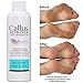 Best Callus Remover.Callus Eliminator,Liquid & Gel For Corn And Callus On Feet. Professional Grade, Does Better Job Than Electric Shaver&Other Scary Tools. (With Moisturizing Socks)