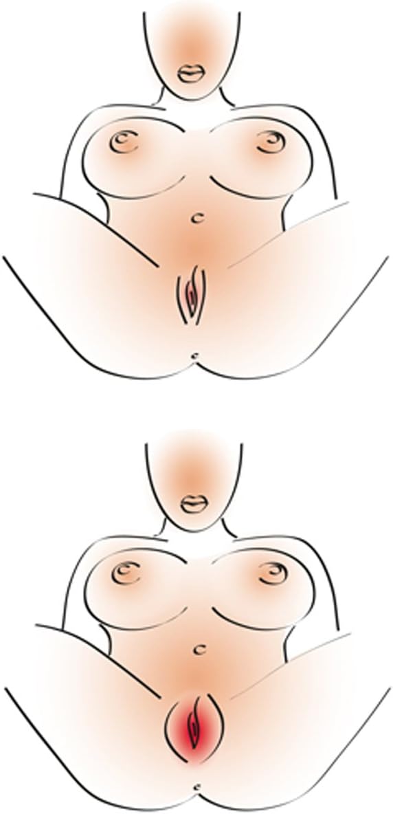 You2Toys The Black Treasure Vaginal Vacuum Suction Cup Pump - Image 4