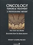 Oncology : A Photographic History, 1901-1915 the X-Ray Era: Tumors and Treatment, Burns, Stanley, 0974868809