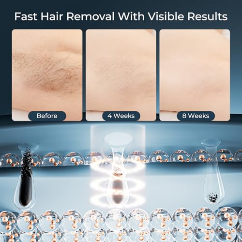 Laser Hair Removal Device with 9 Energy Levels, IPL Hair Removal Device, 999,900 Flashes, at Home Laser Hair Removal Device for Women, Men, Face, Bikini, Body