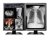 Pair (x2) Eizo RadiForce MX216 2MP 21'' Color LCD