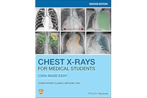 Chest X-Rays for Medical Students: CXRs Made Easy