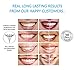 iSmile Teeth Whitening Pen & Charcoal Powder Kit - 35% Carbamide Peroxide Gel & Organic Coconut Charcoal - Professional Strength - No Sensitivity