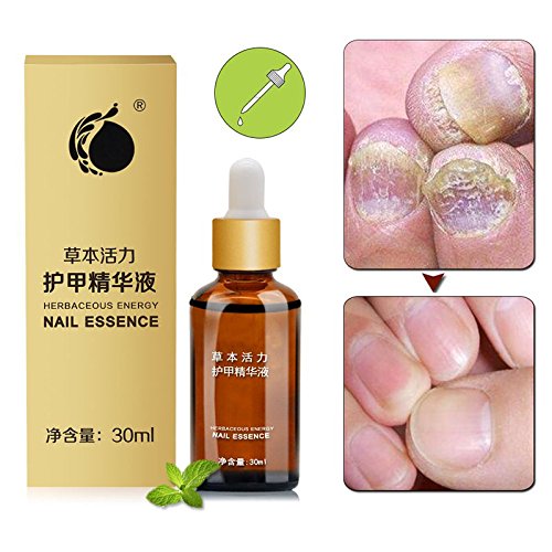 Yiwa Nail Fungus Removal Solution Liquid Anti fungal Nail Solution Fungus Stop Nail Fungus Treatments Anti Infection Nail Whitening Toe