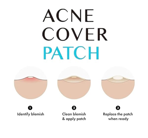 ACNE PIMPLE HEALING PATCH – FAST RESULTS- CLEAR IMPURITIES – SKIN PERFECTING