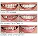 1 Pair Temporary Smile Comfort Fit Cosmetic Teeth,Vovomay Denture Teeth Cosmetic Sticker, Teeth Bottom Sticker (A)