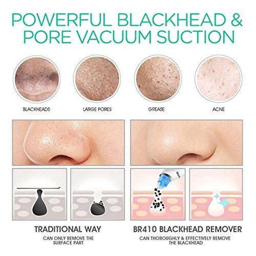 2 VOYOR+Blackhead+Electric+Extractor+Extraction