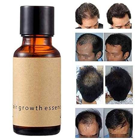 Buy By Pink Strawberry 20ml New Hair Growth Serum Essence For