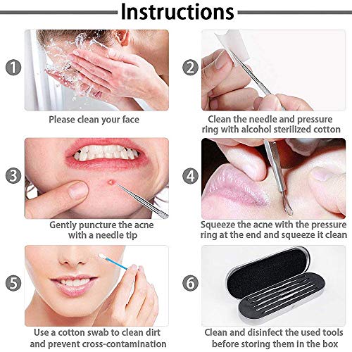 JSDOIN Blackhead Remover Comedone Extractor Tool,Best Acne Removal Kit - Treatment for Blemish, 5-in-1 Professional Zit Removing for Risk Free Nose Face Skin with Metal Case (Blackhead Remover)