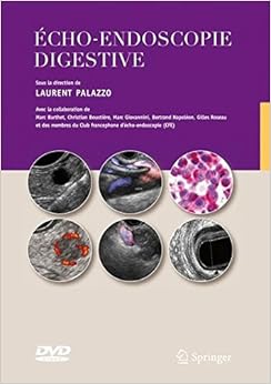 Echo-endoscopie digestive: Avec Dvd-rom, by Laurent Palazzo
