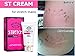 Stretch Mark Remover Cream - Safe Stretch Marks Removal Cream with Snail Secretion Filtrate, Tightens Loose Skin & Heals Stretch Marks Caused by Pregnancy, Weight Gain, Bodybuilding - NET 2.82 Oz. (80 G.)