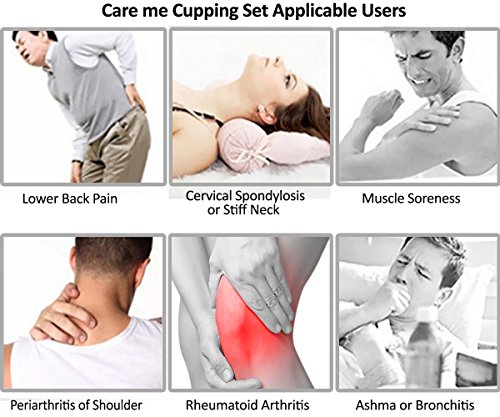 Chinese Acupuncture Cupping Therapy Set-FDA Approved Medical Grade Professional Cupping Kit (14 cups Guaranteed 5-Yr Life)For Body Massage, Pain Relief, Physical Therapy–Improve Your Health & Wellness