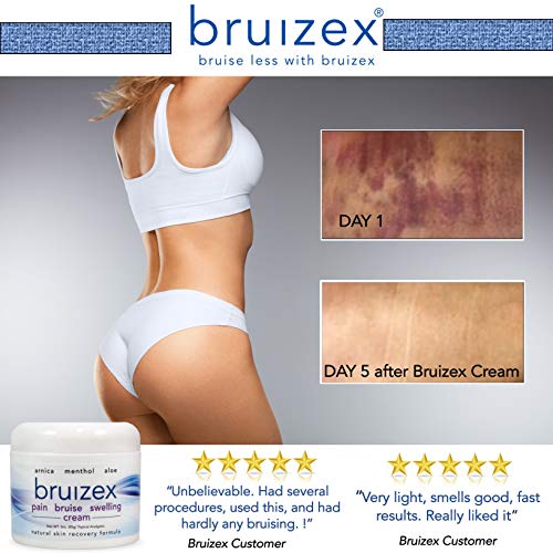 BRUIZEX Pain, Bruise and Swelling Cream, 3 oz. Bruise Removal Cream with Soothing Arnica Gel