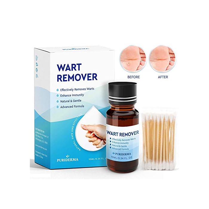 Maximum Strength Wart Removal Treatment by Puriderma PainFree