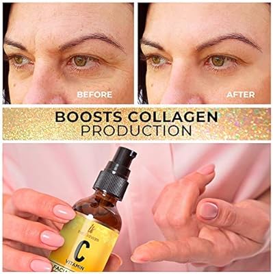 hyaluronic acid serum for pigmentation